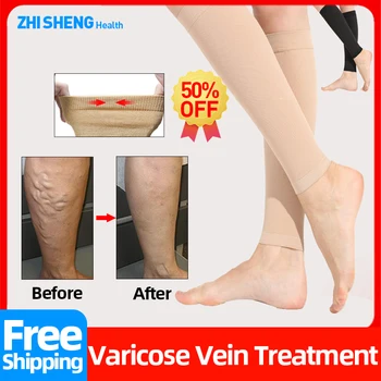  Varice Compresie Sosete Tratamentul Vasculita Inflamație, Flebită Picioare Varicelor Angiitis Dresuri Ciorapi